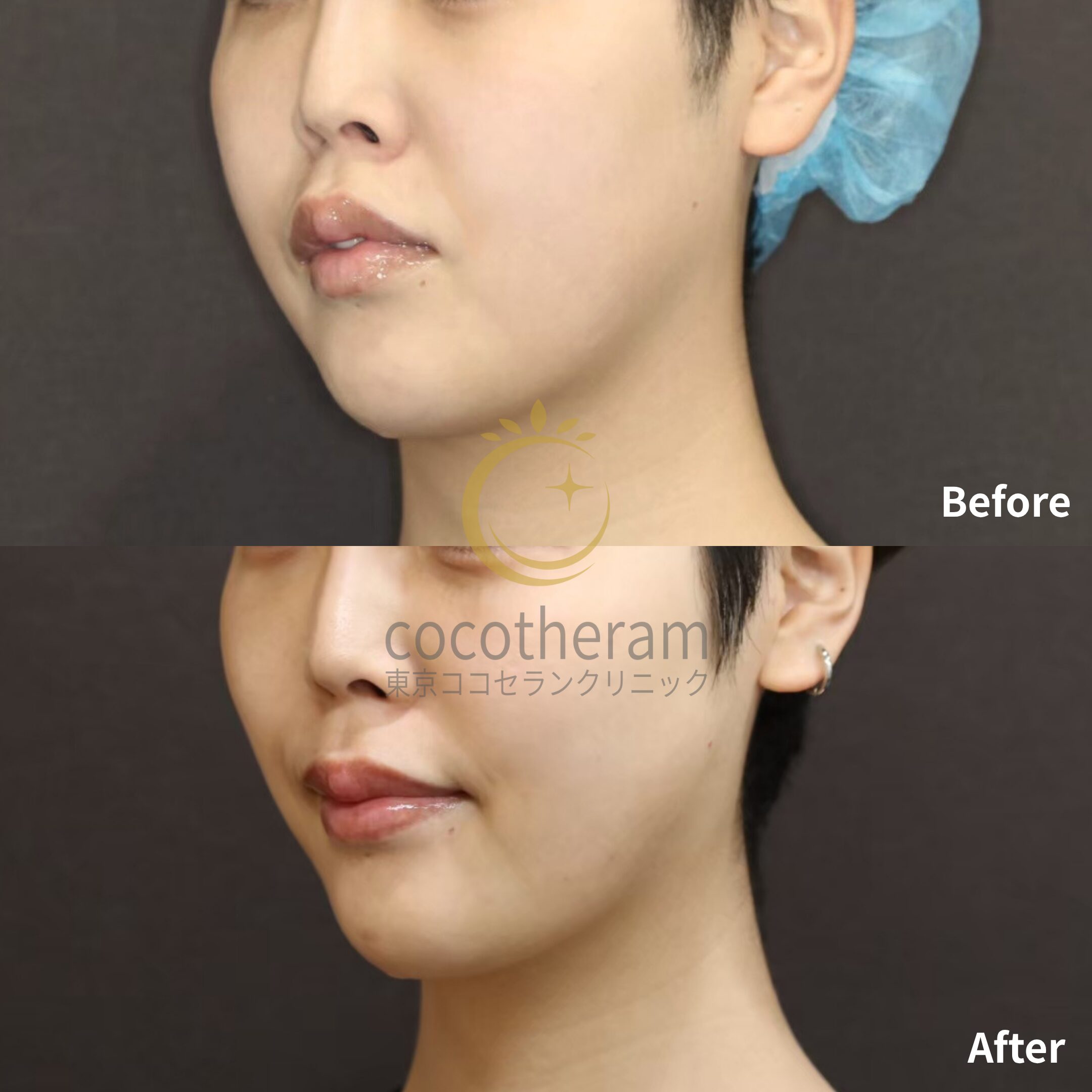 アンカーDXダブル