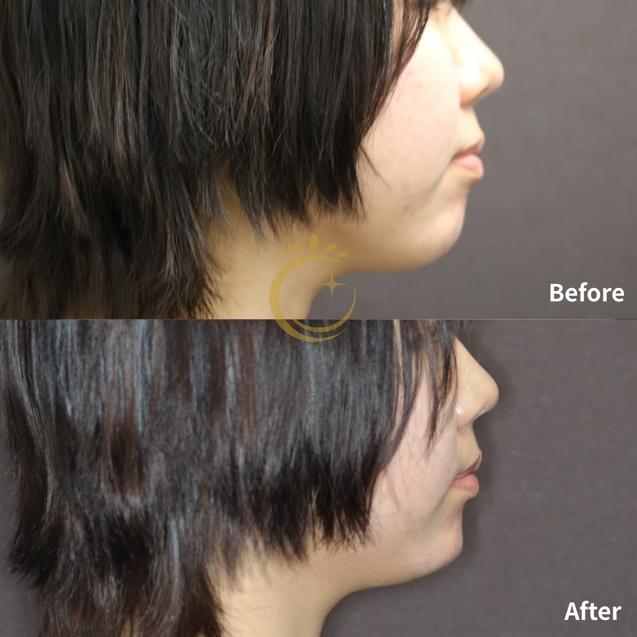 ウルトラプラスXC