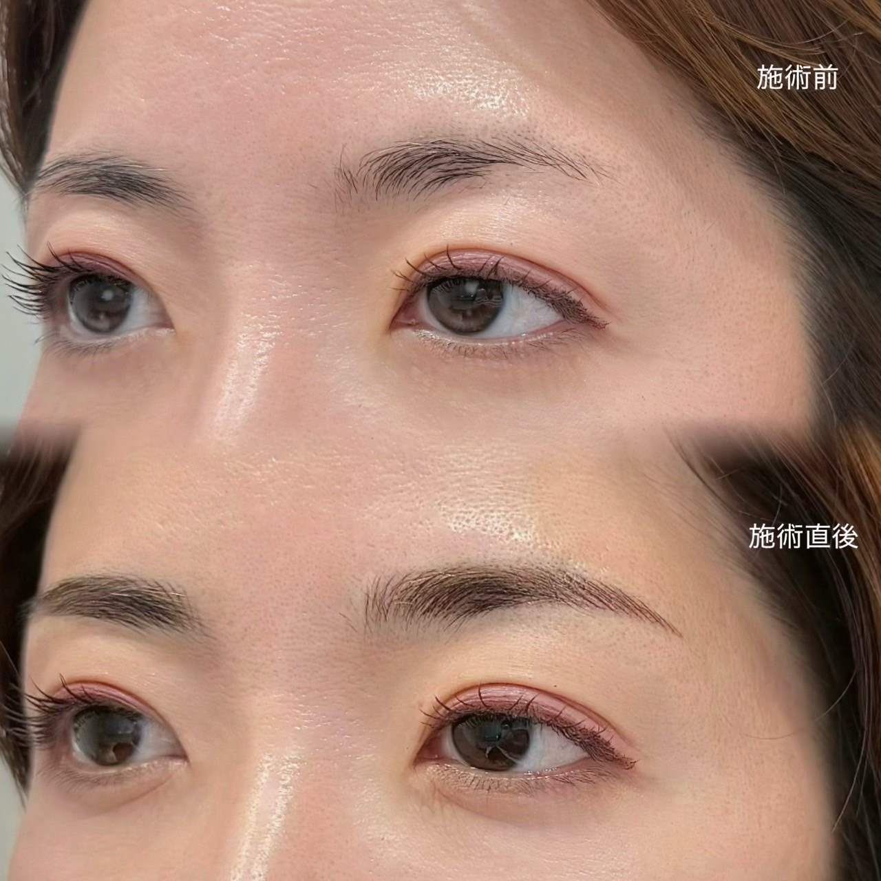 眉アートメイク