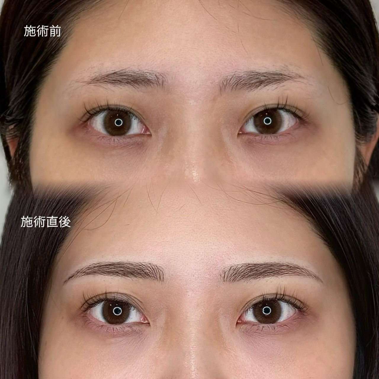 眉アートメイク