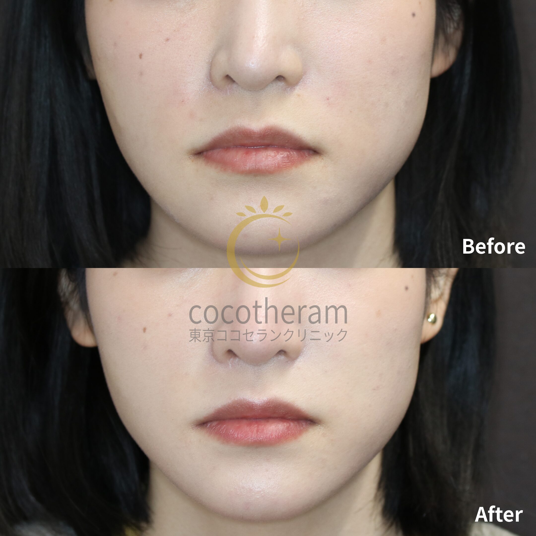 ウルトラXC / ウルトラプラスXC