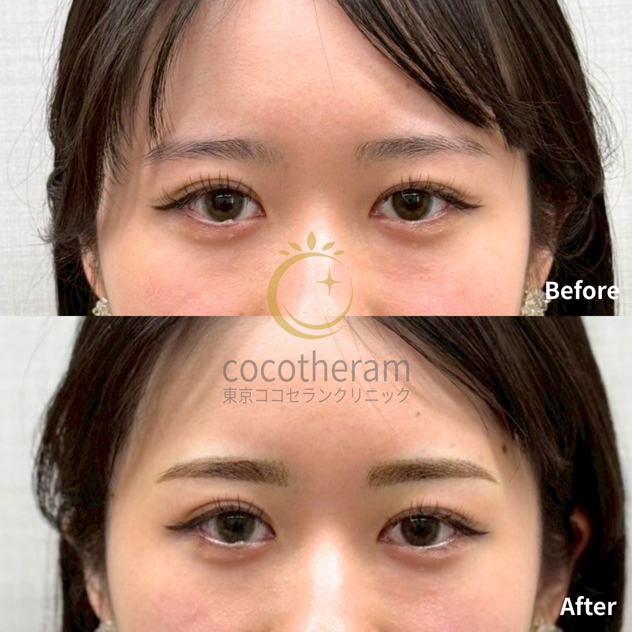 眉アートメイク