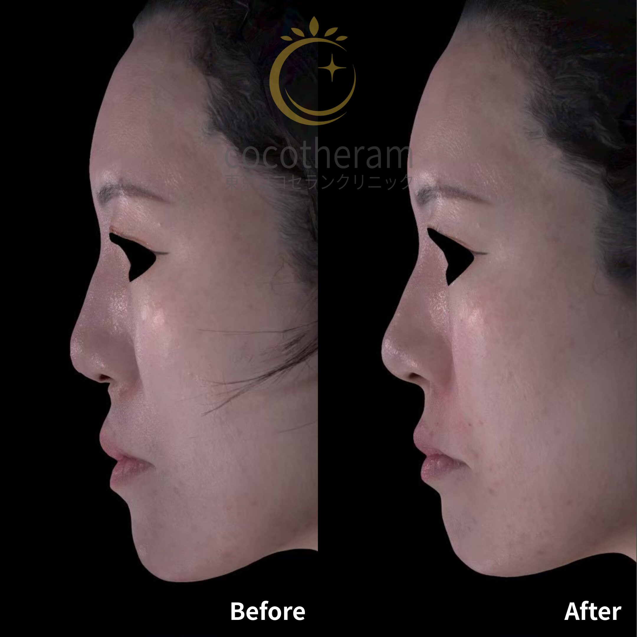 ニュービア　NTENSE