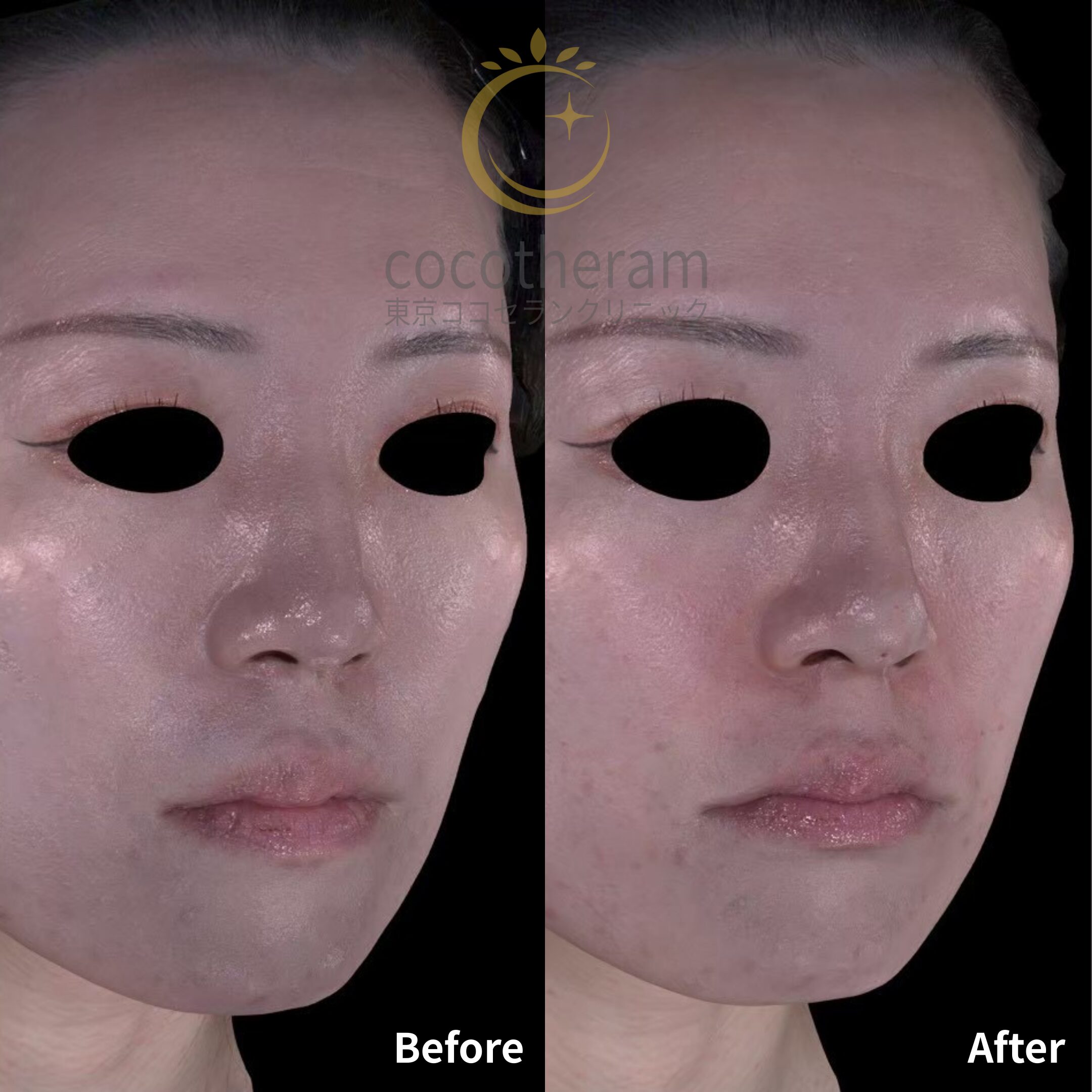 ニュービア　NTENSE