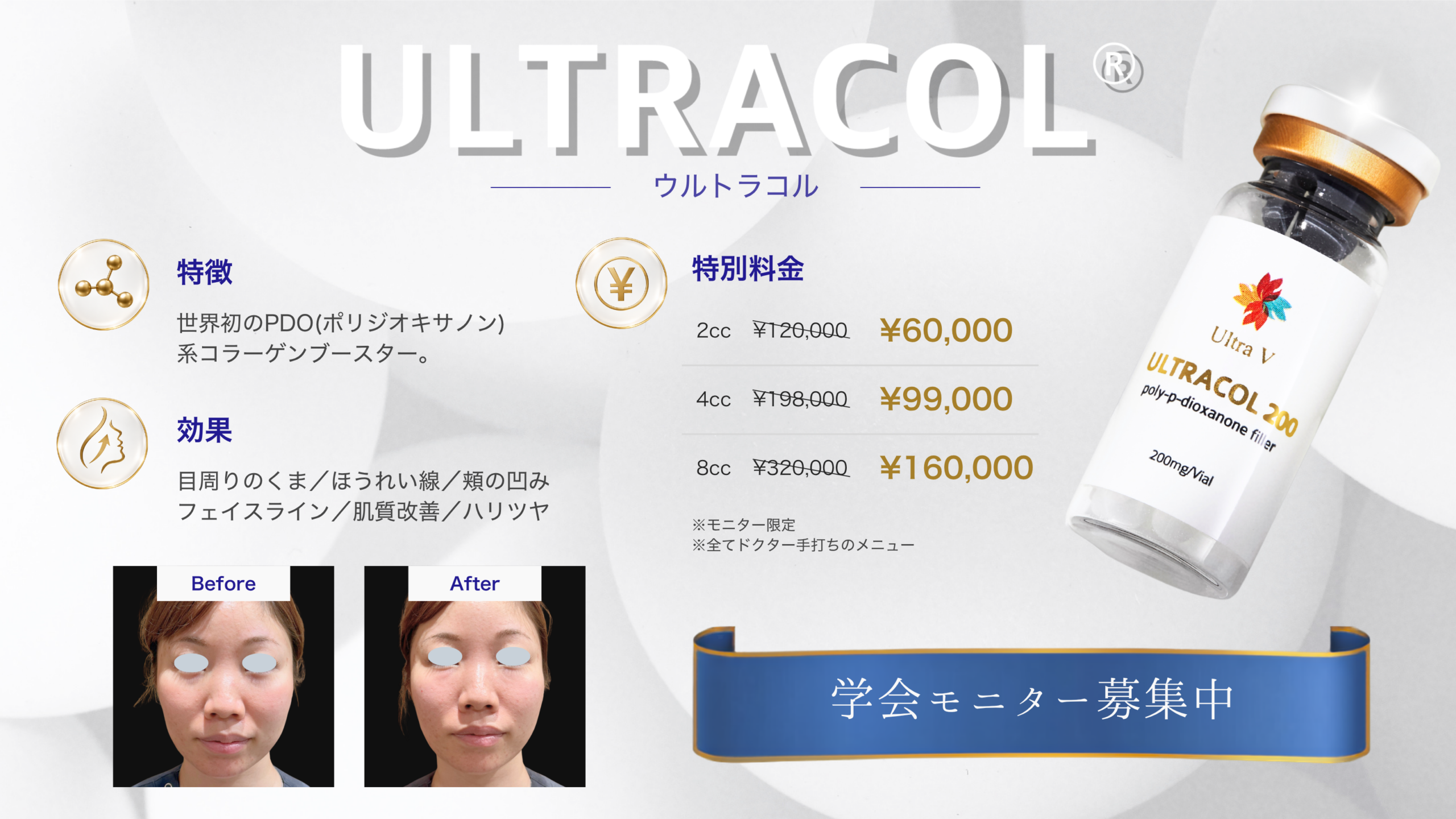 ウルトラコル学会モニターキャンペーン