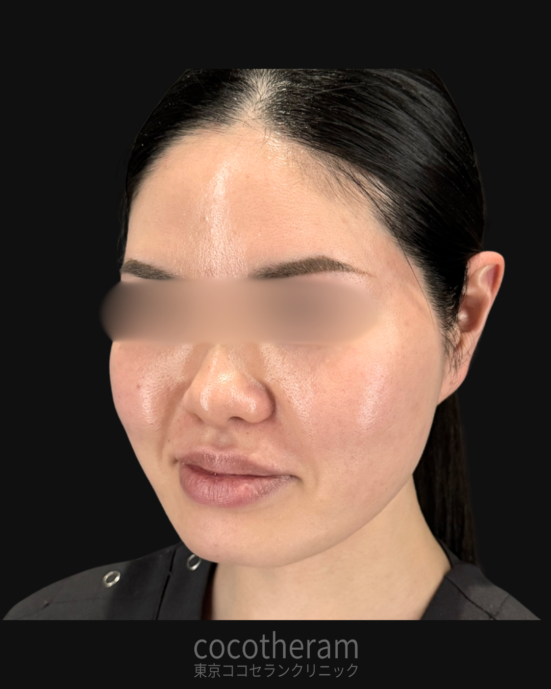Zhoabex　VOLUME